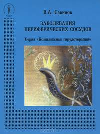 Заболевания периферических сосудов