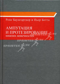 Ампутация и протезирование нижних конечностей