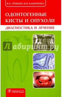 Одонтогенные кисты и опухоли. Диагностика и лечение
