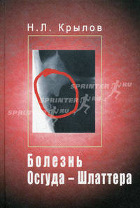 Болезнь Осгуда-Шлаттера
