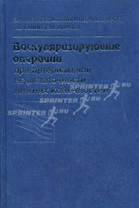 Васкуляризирующие операции при артериальной недостаточности нижних конечностей: руководство для врачей