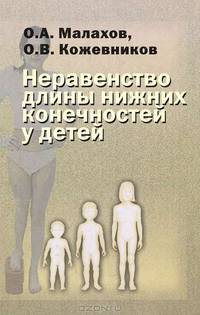 Неравенство длины нижних конечностей у детей (клиническая картина, диагностика, лечение): руководство для врачей