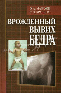 Врожденный вывих бедра (клиническая картина, диагностика, консервативное лечение)