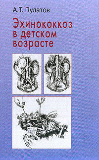Эхинококкоз в детском возрасте