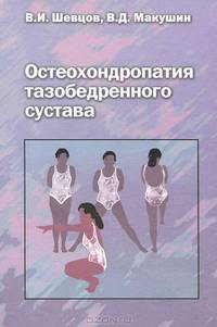 Остеохондропатия тазобедренного сустава: руководство для врачей