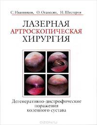 Лазерная артроскопическая хирургия. Дегенеративно-дистрофические поражения коленного сустава..