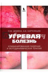 Угревая болезнь. Комбинированная лазерная и фотодинамическая терапия. Руководство для врачей