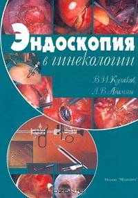 Эндоскопия в гинекологии: Руководство для врачей