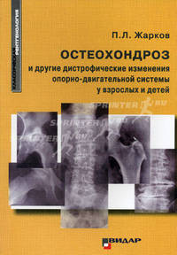 Остеохондроз и другие дистрофические изменения опорно-двигательной системы у взрослых и детей