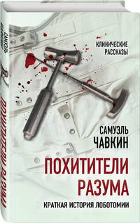 Похитители разума. Краткая история лоботомии