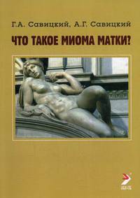 Что такое миома матки? Руководство