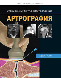 Артрография