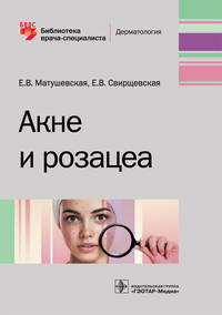 Акне и розацеа