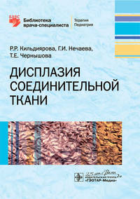 Дисплазия соединительной ткани
