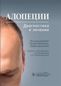Алопеции. Диагностика и лечение