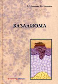 Базалиома
