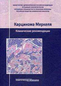 Карцинома Меркеля. Клинические рекомендации. Гриф Министерства Здравоохранения