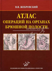 Атлас операций на органах брюшной полости Изд. МИА
