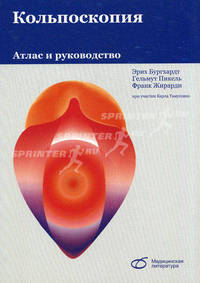 Кольпоскопия. Атлас и руководство
