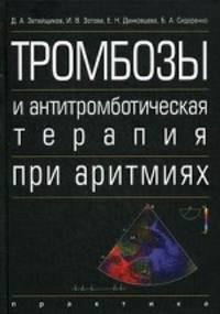 Тромбозы и антитромботическая терапия при аритмиях