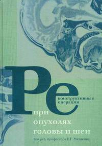 Реконструктивные операции при опухолях головы и шеи..