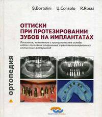Оттиски при протезировании зубов на имплантантах. Показания, назначение и принципиальные основы нового поколения стерильных и рентгеноконтрастных оттискных материалов