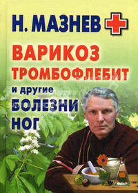 Варикоз, тромбофлебит и другие болезни ног