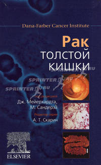 Рак толстой кишки