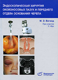 Эндоскопическая хирургия околоносовых пазух и переднего отдела основания черепа