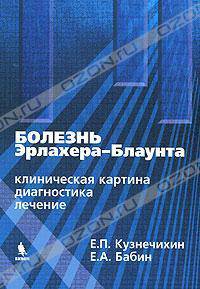 Болезнь Эрлахера-Блаунта (клиническая картина, диагностика, лечение)