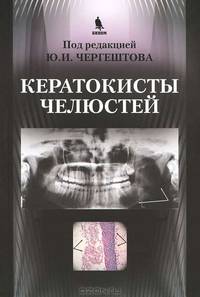 Кератокисты челюстей.