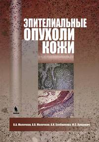 Эпителиальные опухоли кожи