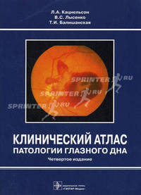 Клинический атлас патологии глазного дна.