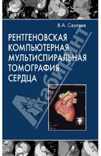 Рентгеновская компьютерная мультиспиральная томография сердца (без скидки)руководство