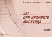ЭКГ при инфаркте миокарда. Атлас. + линейка электрокардиографическая (+ )