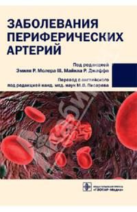 Заболевания периферических артерий: руководство