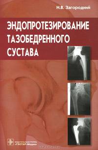 Эндопротезирование тазобедренного сустава. Основы и практика: руководство. Загородний Н.В.