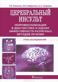 Церебральный инсульт: нейровизуализация в диагностике и оценке эффективности различных методов лечения. Атлас исследований