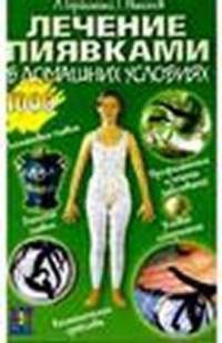 Лечимся пиявками