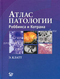 Атлас патологии Роббинса и Котрана. Клатт Э. К.