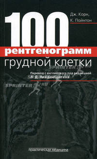 100 рентгенограмм грудной клетки.