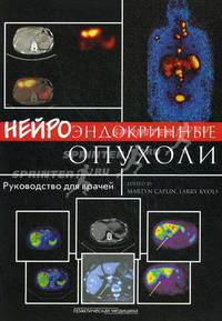 Нейроэндокринные опухоли. Руководство для врачей