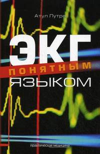 ЭКГ понятным языком