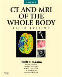 CT and MRI of the Whole Body, 2-Volume Set, 5e