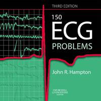 150 ECG Problems