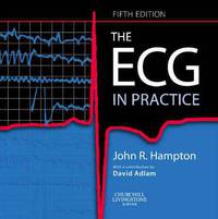 The ECG in Practice