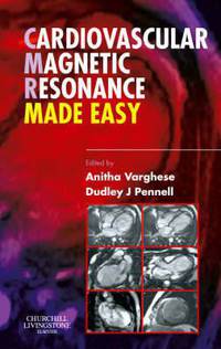 Cardiovascular Magnetic Resonance Made Easy,