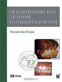 Ортодонтическое лечение парными блоками