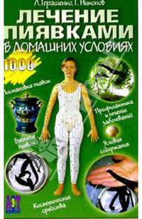 Лечение пиявками в домашних условиях