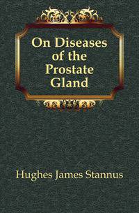 On Diseases of the Prostate Gland